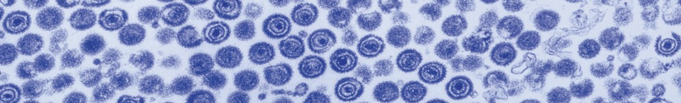 Electron microscope image of the chicken pox virus.